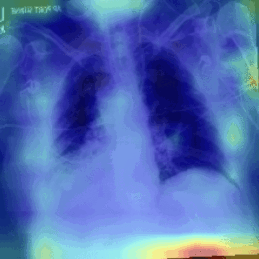 ViT Attention Visualization